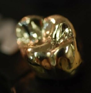 Full Cast Gold 