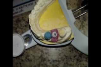 Steps to Fabricating Zirconia Crown and Abutment